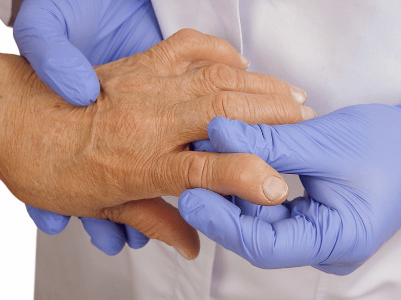 Le médecin examine la main pour déceler des douleurs dans les articulations des doigts